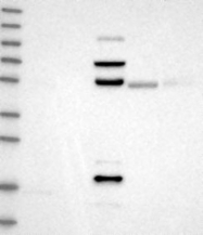NBP1-82880 - Rhophilin 1 / RHPN1
