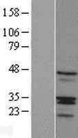 NBL1-15365 - RIBC1 Lysate
