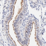 NBP1-86814 - RIBC2