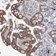 NBP1-92334 - ARHGAP32 / RICS