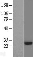 NBL1-17622 - RING finger protein unkempt like Lysate