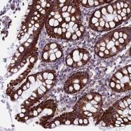 NBP1-87826 - UQCRFS1 (Complex III subunit Rieske)