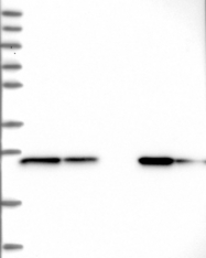 NBP1-87826 - UQCRFS1 (Complex III subunit Rieske)