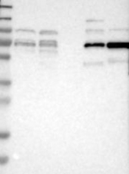NBP1-86629 - RIPK2