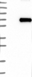 NBP1-86630 - RIPK2