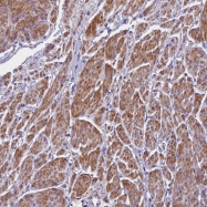 NBP1-87999 - MEX3B / RKHD3