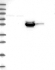 NBP1-87999 - MEX3B / RKHD3