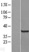 NBL1-15223 - RNA binding motif protein, X-linked 2 Lysate