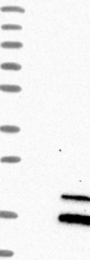 NBP1-86134 - RNASE7