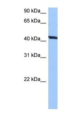 NBP1-60000 - TMEM118 / RNFT2