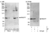 NBP1-49972 - RNGTT / HCE