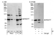 NBP1-49973 - RNGTT / HCE
