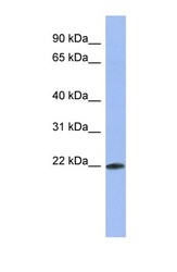 NBP1-57503 - RBM38