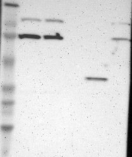 NBP1-87230 - RNASEL