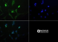 NBP1-71687 - ROBLD3