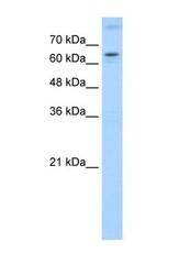 NBP1-52813 - ROR-alpha / RORA