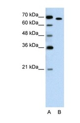 NBP1-52828 - ROR-alpha / RORA