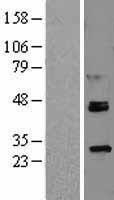 NBL1-15479 - ROR alpha Lysate