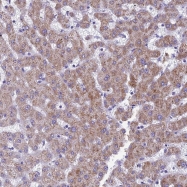 NBP1-87394 - MIIP / IIP45