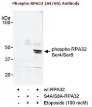 NBP1-23017 - RPA2