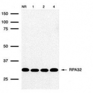 NB100-158 - RPA2