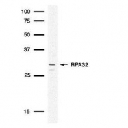 NB100-347 - RPA2