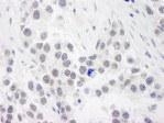 NB100-2204 - RPA1