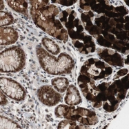 NBP1-89658 - RPA1