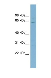 NBP1-58121 - RPA1