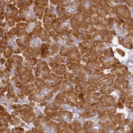 NBP1-92345 - RPL13A