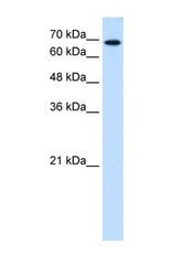 NBP1-62480 - Ribophorin-2 / RPN2