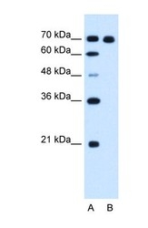 NBP1-58069 - RRM1 / RR1