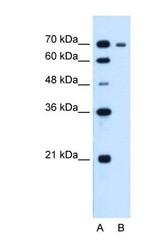 NBP1-58187 - RRM1 / RR1