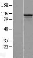 NBL1-15597 - RSBN1L Lysate