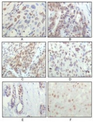 NBP1-47405 - RPS6KA1