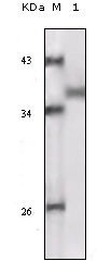 NBP1-47405 - RPS6KA1