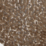 NBP1-81285 - TMEM7 / RTP3