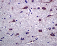 NBP1-95933 - Tyrosine-protein kinase RYK