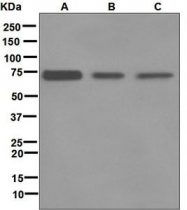 NBP1-95933 - Tyrosine-protein kinase RYK