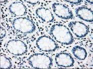 NBP1-47946 - RAD9A
