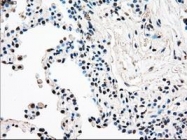 NBP1-47946 - RAD9A