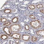 NBP1-85238 - Radixin / RDX