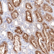 NBP1-85239 - Radixin / RDX