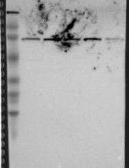 NBP1-85238 - Radixin / RDX