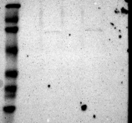 NBP1-85239 - Radixin / RDX