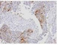 NBP1-32350 - XPO7 / Exportin-7