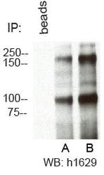 NBP1-49542 - RBBP6 / RBQ1