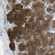 NBP1-89721 - HFE2 / Hemojuvelin