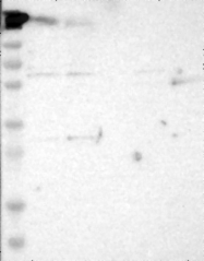 NBP1-89721 - HFE2 / Hemojuvelin