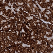 NBP1-82524 - Reticulon 2 / RTN2